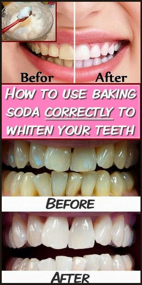 Brushing Teeth With Peroxide And Baking Soda A Natural And Effective