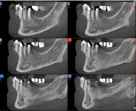 Clínicas Para Exame De Tomografia Dental Em Sp Feital Clínicas Para