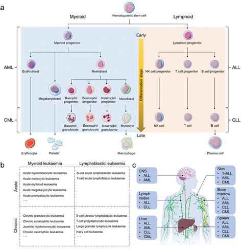 Schematic Illustration Of Leukemia Development Classification And