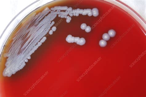 Burkholderia Pseudomallei Bacteria Stock Image C056 3542 Science