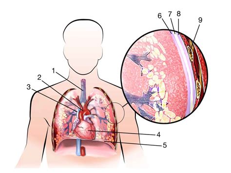 Pleura Diagram Quizlet