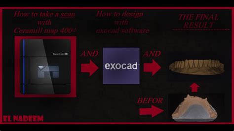 How To Scan With Amann Girrbach Ceramill Map 400 And Desing With Exocad