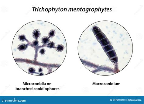 Fungi Trichophyton Mentagrophytes 3d Illustration Stock Illustration