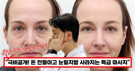 눈 밑 지방이 거짓말처럼 사라졌어요 유명 성형외과 의사가 알려주는 돈 안들이고 눈 밑처짐 없애주는 기가막힌 방법 뉴스를 싣고