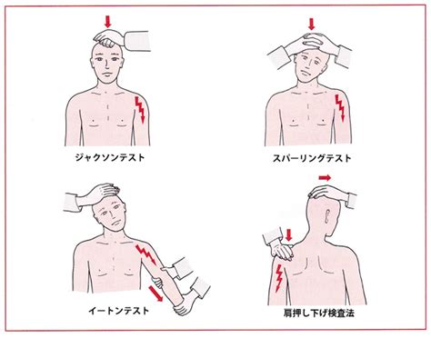 ムチウチ（頚椎捻挫・頸部損傷） 【公式】メディカルジャパン渋谷 実績と信頼の整体・鍼灸院