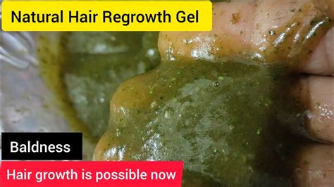 Hair Regrowth Gelcream You Can Make At Homecomplete Treatment For