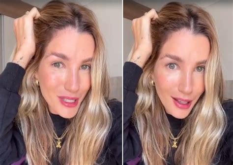 Aline Gotschalg Quando M Dico Foi Retirar Minha Tireoide Viu