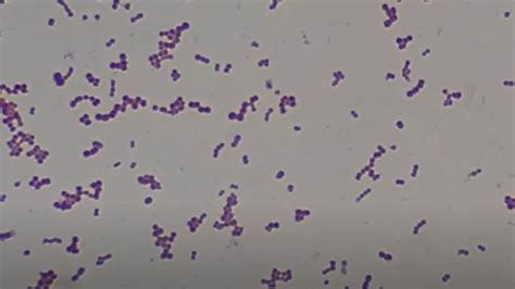 Diplococci Gram Positive