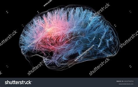 3d Illustration Brain Tractography Stock Illustration 2212754753 ...