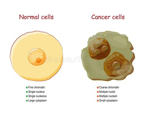 Cancer Cells Cancer Foci And Metastases Stock Vector Illustration Of Capillary Diagram 72367191