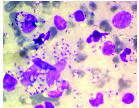 Giemsa Stain Principle Procedure Results Microbe Online