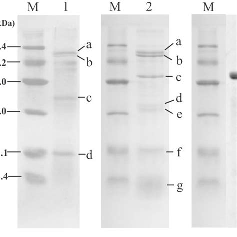 SDS PAGE Pattern Of Proteins Extracted From Soya Hulls By Two Methods