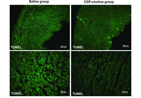 Figure Shows The Apoptotic Cells Using TUNEL Assay In Fluorescence