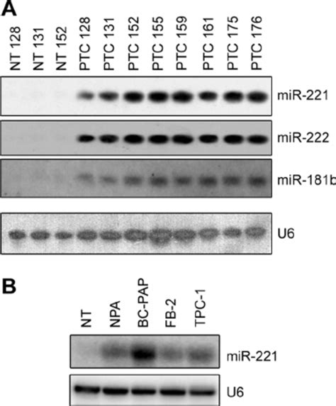 A Northern Blot Analysis Performed On Human Ptc Samples The Probe