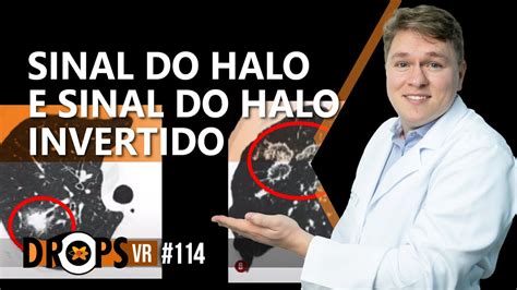 SINAL DO HALO E SINAL DO HALO INVERTIDO EM QUE DOENÇAS PRECISAMOS