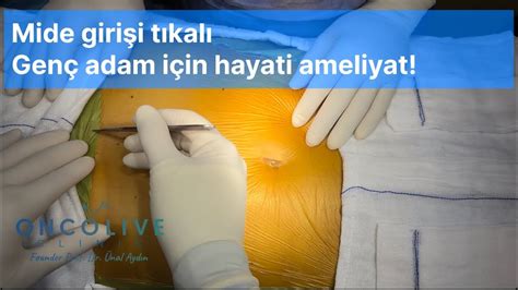 MİDE GİRİŞİ TIKALI GENÇ ADAM İÇİN HAYATİ AMELİYAT I Prof Dr Ünal