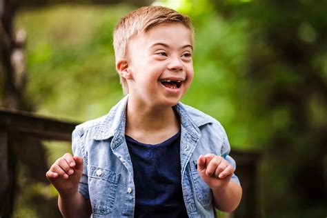 Down Syndrome Causes Symptoms Diagnosis And Treatment