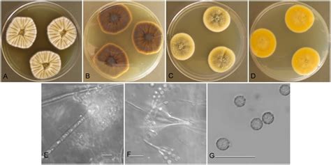 Aspergillus Jensenii Nrrl Culture Plates Are Cm Diam