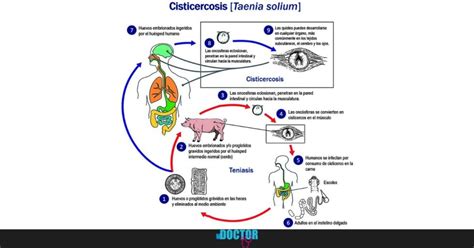 Cisticercosis La Enfermedad Humana Que Hace Estragos