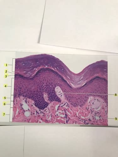 Epidermis And Dermis Of Thick Skin Longitudinal Section 400x