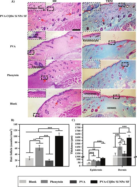 Histological Evaluation Of Rat Skin After Days Of Postoperation A