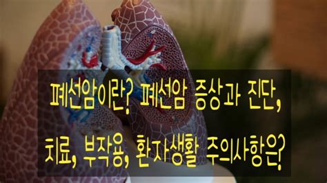 폐선암이란 폐선암 증상과 진단 치료 부작용 환자생활 주의사항은 네이버 블로그