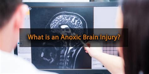 What Is An Anoxic Brain Injury Injury Lawyer Of Edmonton