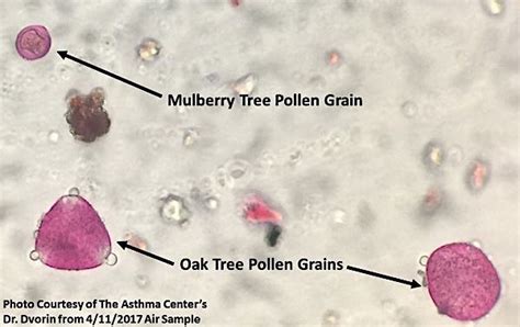 Pine Pollen Microscope