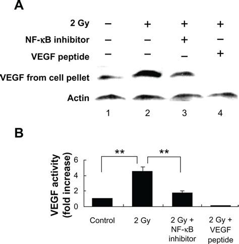 Radiation Induced Intracellular VEGF Expression In MCF 7 Cells Is