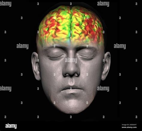 Human Brain Coloured Functional Magnetic Resonance Imaging Fmri Scan Of A Normal Adult Human