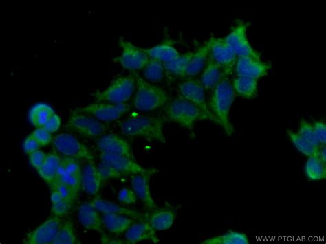 TGF-beta 1 Antibody 21898-1-AP | Proteintech