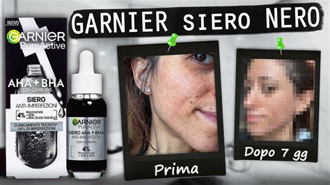 Recensione Garnier Siero Nero Anti Imperfezione Con Carbone Testato