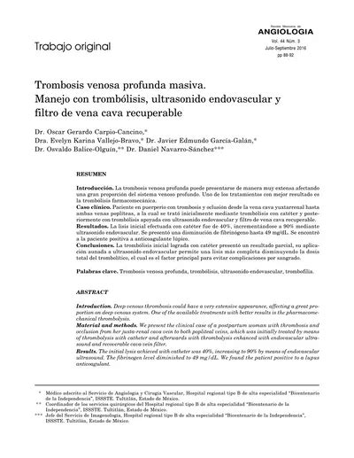 Trombosis Venosa Profunda Masiva Manejo Con Tromb Lisis Ultrasonido