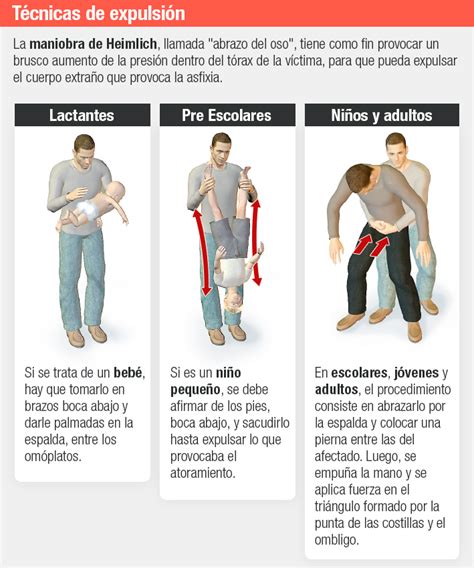 Maniobra De Heimlich C Mo Realizar La T Cnica Que Puede Salvar Vidas