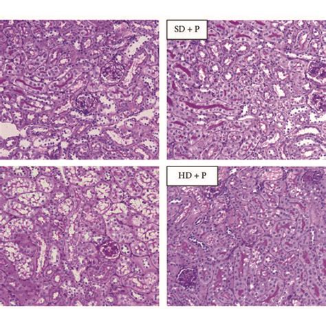 Effects of HD and pyridoxamine administration on kidney structure. (a)... | Download Scientific ...