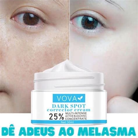 Creme Bom Para Melasma - Creme para Melasma - Melaslow – Saúde no Cotidiano