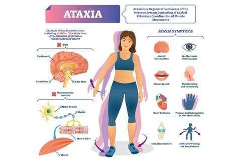 Foto : Ataksia