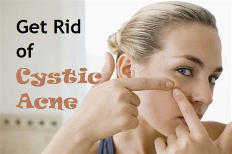 How To Get Rid Of Cystic Acne