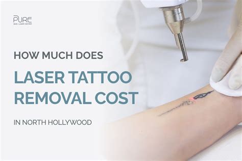 How Much Does Laser Tattoo Removal Cost In North Hollywood