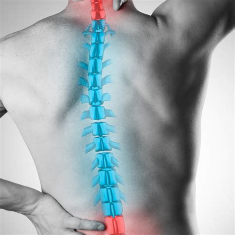 Cervical Myelopathy Surgery in NYC: Unmatched Expertise | Rothman ...