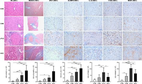 Ihc Staining Of The Liver Sections Hande Staining Magnification ×200 Download Scientific