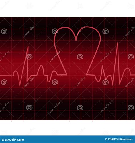 Ekg Royalty Free Stock Photo Image 13945495