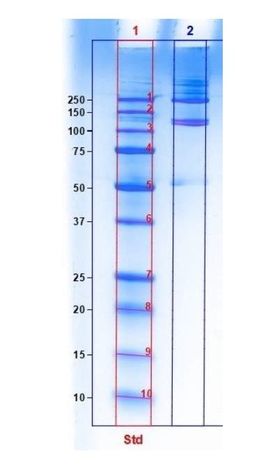 Physicochemical Properties Of Acid Soluble Collagen Extracted From