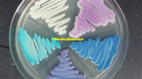 Candida Parapsilosis Introduction Morphology Pathogenicity Lab