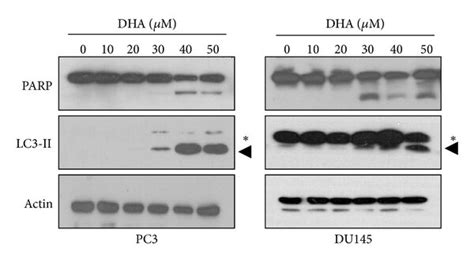 Dha Induces Apoptosis And Autophagic Activation In Pc And Du