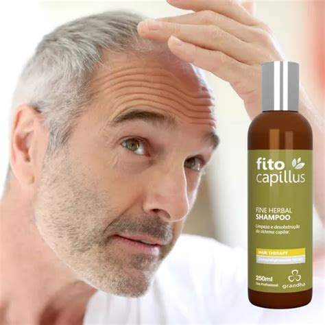 Shampoo Fitoter Pico Para Calv Cie E Alopecia Anti Queda Parcelamento