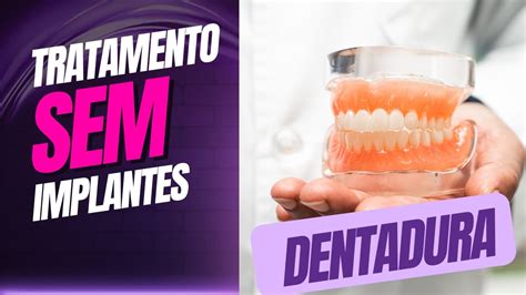 Tratamento Sem Implante Pr Tese Total Dentadura Youtube