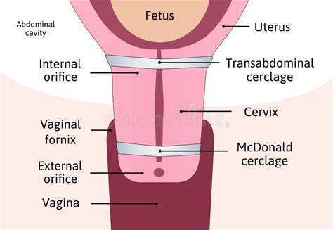 Pregnancy Open Vs Closed Cervix Pictures How To Check Your Cervical