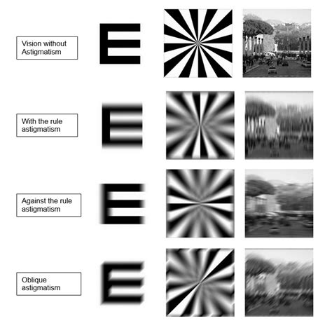 Astigmatism What Is It Causes And Treatment