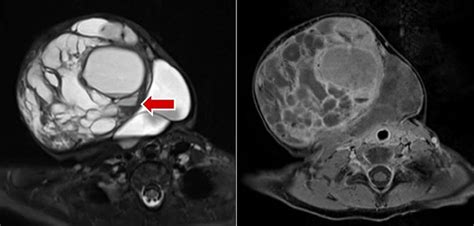 Compva Magnetic Resonance Imaging